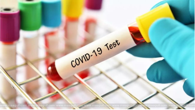 ఏపీలో కరోనా కేసుల వివరాలు